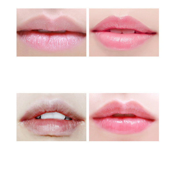 Improve Lip Lines